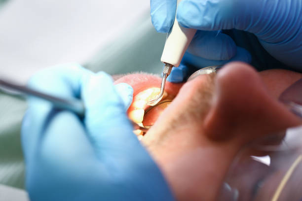 Best Broken or Cracked Tooth Emergency Dentist in Brookings, SD